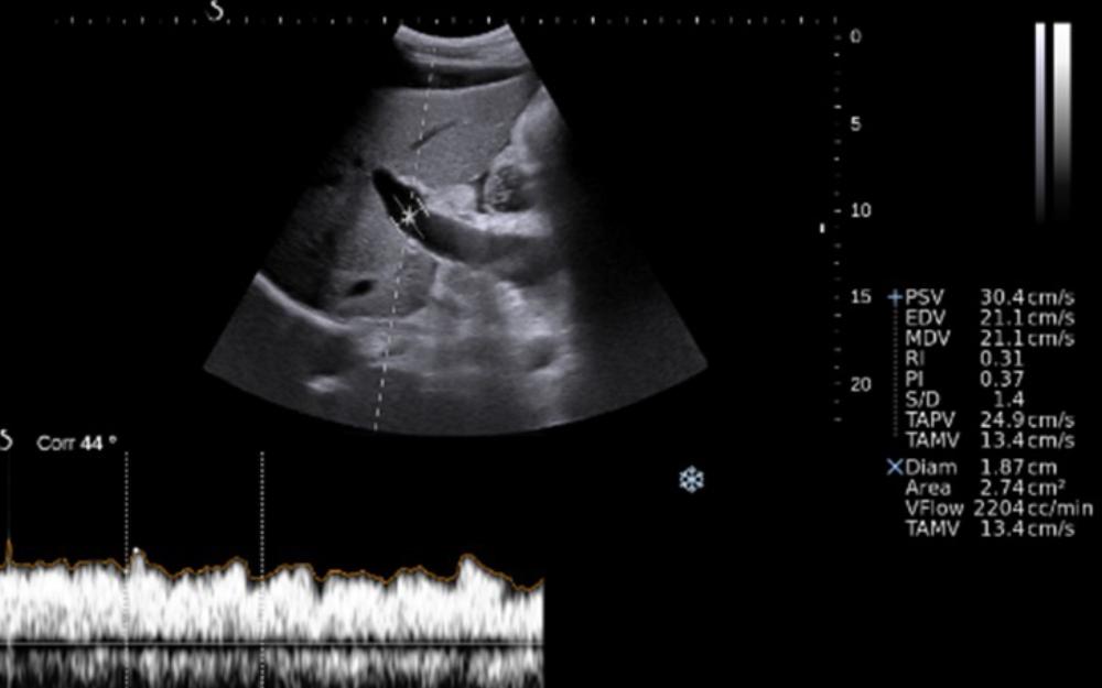 BASL hepatology